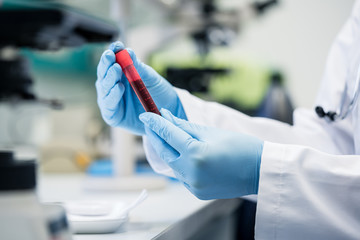 Wissenschafter im biologischen Labor mit Bluttest