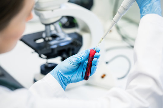 Arzt oder Laborant f&uuml;llt L&ouml;sung in Bluttest im Labor