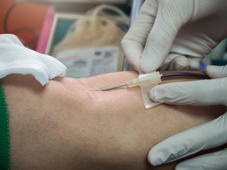 Fototapeta na wymiar Nurse stabbing medical needles to donor arm. Blood Donor Making Donation In Hospital.