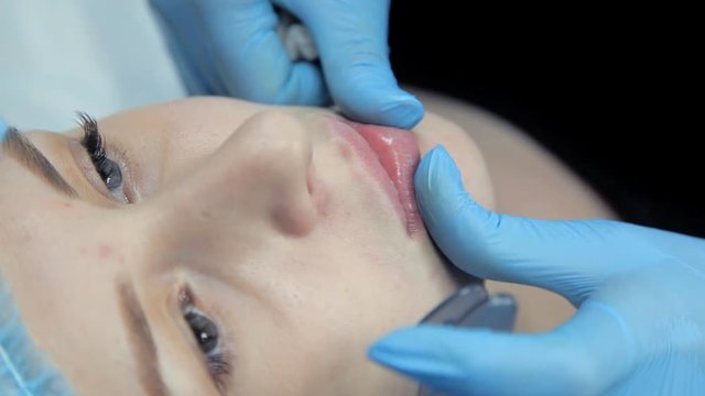 The beautician smoothes botox in the lips of a young girl after the injection. Lip augmentation procedure.