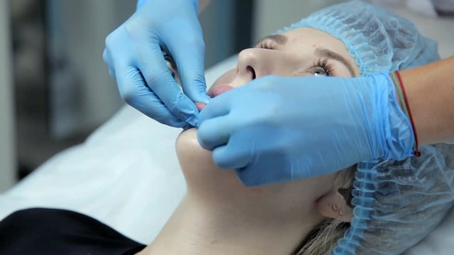 The beautician smoothes botox in the lips of a young girl after the injection. Lip augmentation procedure.