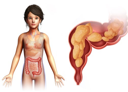 Child's rectum, illustration
