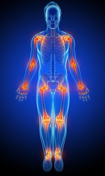 Male joint pain, illustration
