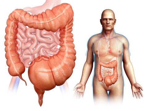 Man with mega colon, illustration