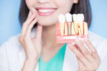 woman dentist take implant tooth - obrazy, fototapety, plakaty