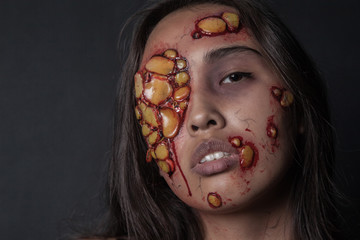 Girl with sores and blood on their face. realistic Halloween makeup.