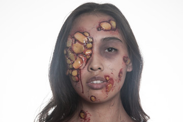 Girl with sores and blood on their face. realistic Halloween makeup.
