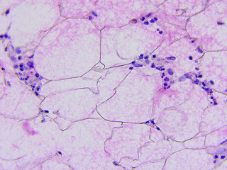 Microscopic photography of mucous membrane of the appendix, color test for enzymes, positive mucus