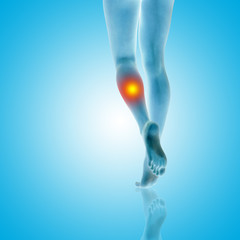 Conceptual beautiful woman or girl legs and feet with a hurt calf pain or ache closeup, 3D illustration of human slim fit body medical or health care concept, painful sport injury on blue background © high_resolution