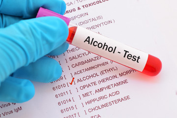 Blood sample with requisition form for alcohol test
