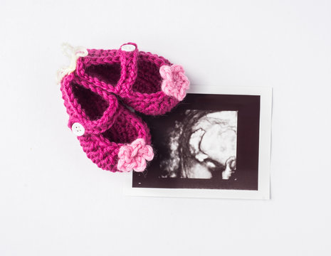 photo of ultrasound baby foot with cute pink wool shoe isolated on white background
