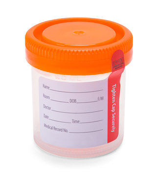 Urine Sample Cup