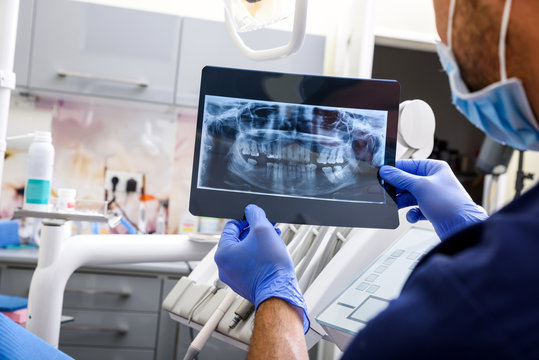 A Dentist explaining a XRAY image