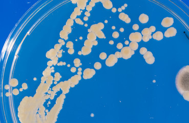 Pile petri dish with growing cultures of microorganisms in doctor hand , fungi and microbes. A...