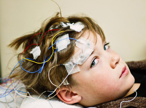 Close-Up portrait of a Boy getting an EEG procedure for epilepsy