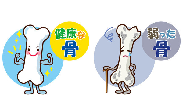 健康な骨 弱った骨 キャラクター Stock Illustration Adobe Stock 健康な骨 弱った骨 キャラクター Stock Illustration Adobe Stock