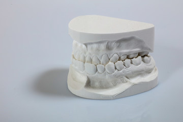 Teeth mold