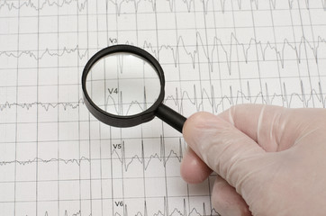 Electrocardiogram on paper. Hand in medical glove holding a magnifying glass