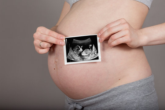 pregnant belly with ultrasound image on neutral grey background