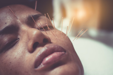 Asian women 40 years old acupuncture acupuncture on face to maintain health and skin to be healthy, firm skin.
