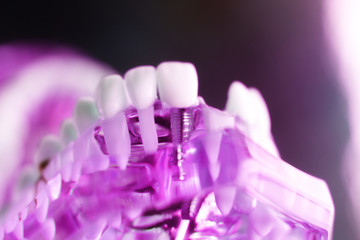 Dentsts dental teeth model