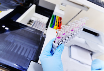 a glass test tube or a flask with blood in the hands of a scientist on the background of a laboratory