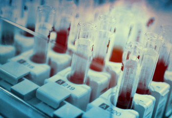 a glass test tube or a flask with blood in the hands of a scientist on the background of a...