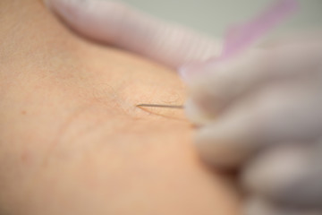 close up of a syringe getting in patients skin