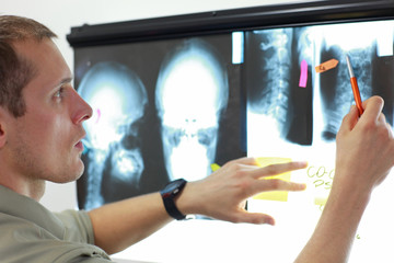 Specialist watching images of skull and spine at xray film viewer. Diagnosis,treatment planning