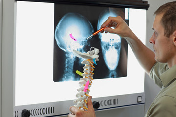 Professional with model of human spine watching images of skull  at x-ray film viewer, Diagnosis,treatment planning