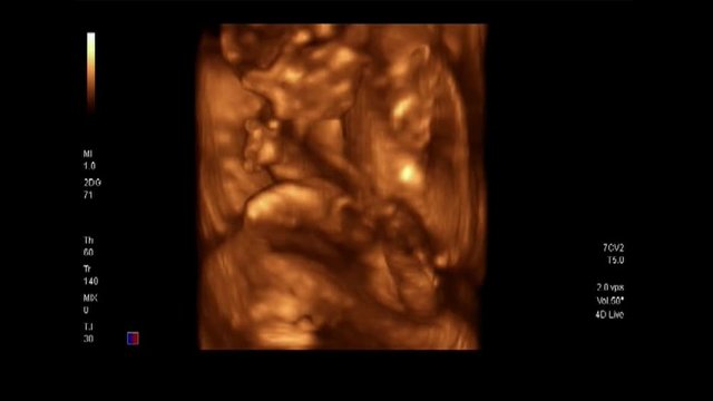 4D Ultrasound of baby body in mother's womb.