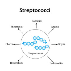 Streptococci. Streptococcal diseases. Infographics. Vector illustration - obrazy, fototapety, plakaty