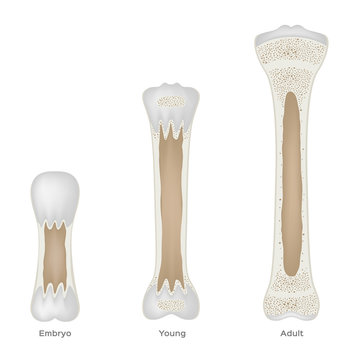 Child Bone Growing To Adult Bone Vector