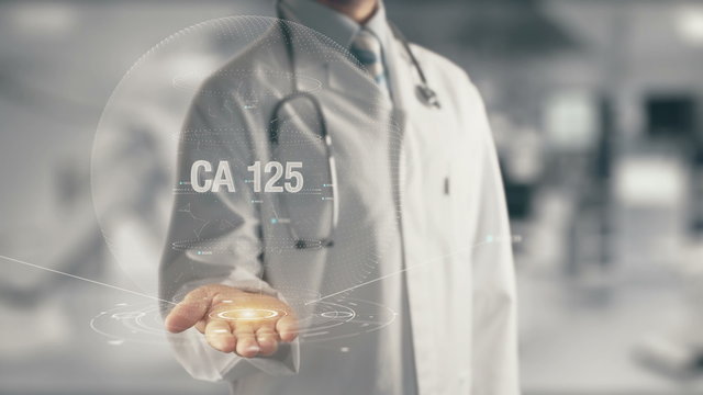 Doctor holding in hand CA 125