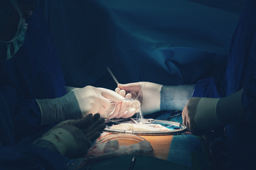 Team of surgeons minimally invasive aortic valve surgery replacement with sutures placed of each...