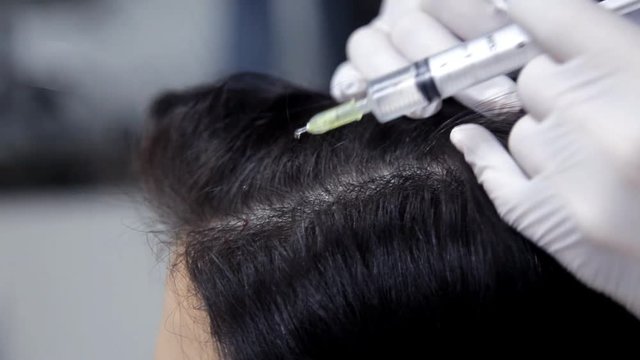 In the clinic, the cosmetologist makes mesotherapy injections to the client to improve the condition of the hair. Close-up