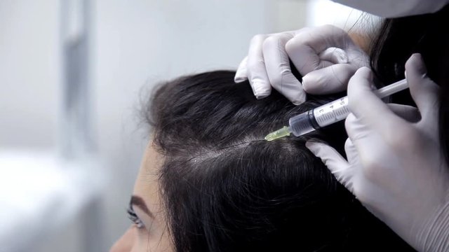The doctor-cosmetologist performs the procedure of mesotherapy, injections into the skin of the head. Close-up