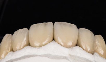 Fototapeta na wymiar dental crown