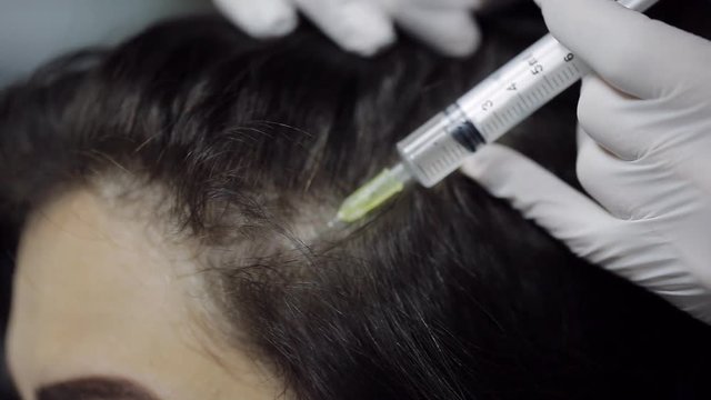 treatment of scalp hair. mesotherapy of the head. close-up