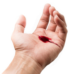 Hand of man injured wound from accident and blood bleeding on white background , insurance concept