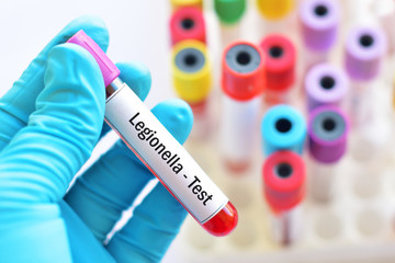 Fototapeta premium Blood sample for legionella (Legionnaires disease) test