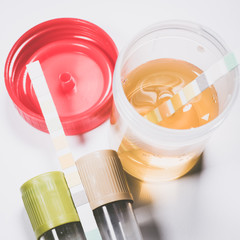 A plastic cup with urine test