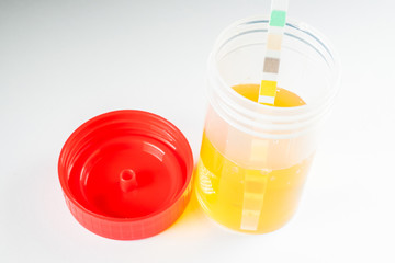 A plastic cup with urine test