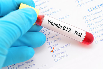Blood sample with requisition form for vitamin B12 test