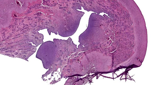 cross section cut of uterus under the microscope