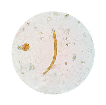 Stool parasites examination test for parasites or eggs in human stool sample with iodine stained under microscope. The parasites are associated with intestinal infections. Clipping path.