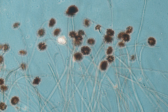 Aspergillus fungus