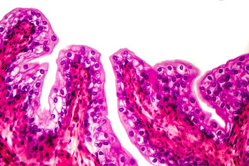 Transitional epithelium tissue of the urinary bladder under microscope, light micrograph,...