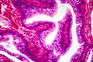 Transitional epithelium tissue of the urinary bladder under microscope, light micrograph,...