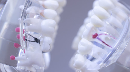 Dental teeth mouth model